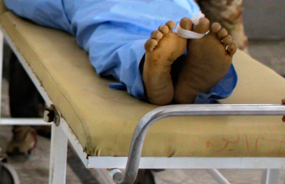 ஹபரண சஃபாரி வாகன விபத்தில் ஒருவர் பலி